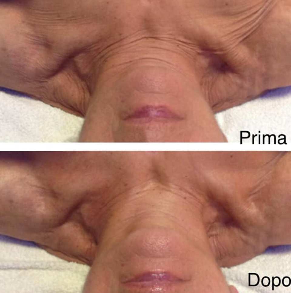 estetica_piu_bella_redazionale_viso-mag19-bb