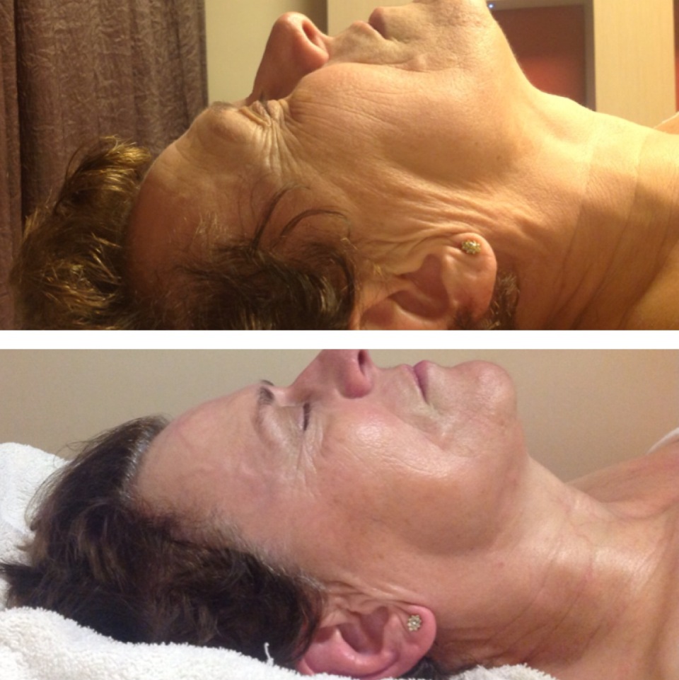 estetica_piu_bella_redazionale_viso-mag19-cc