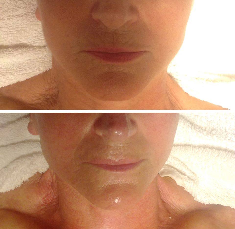 estetica_piu_bella_redazionale_viso-mag19