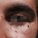 Coppia gay aggredita a Pisa