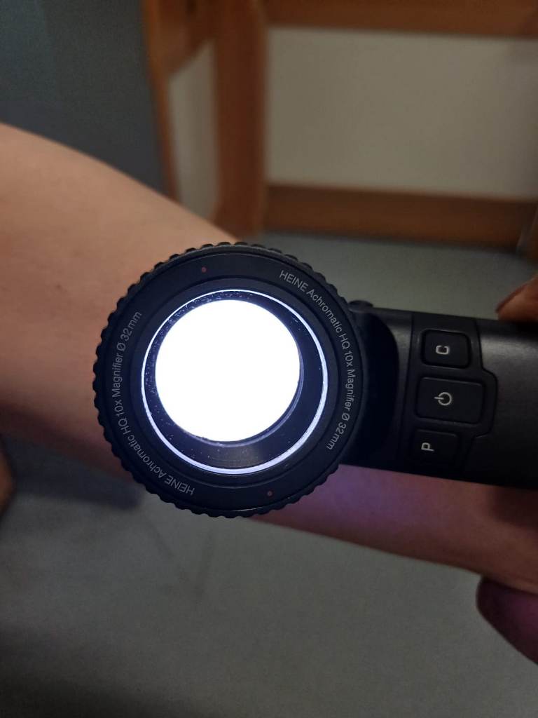 Dermatoscopio Nottola - Foto 2