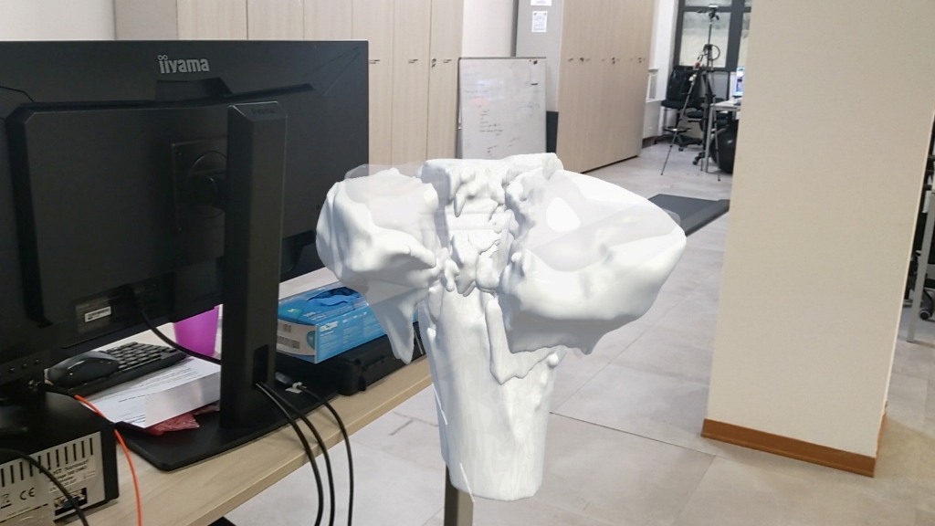 UniPi realtà aumentata chirurgia