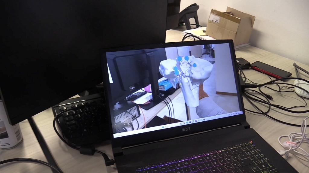 UniPi realtà aumentata chirurgia