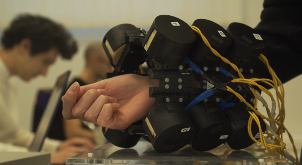 La mano robotica che "sente" il movimento: lo studio del Sant'Anna di Pisa
